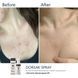 Спрей-концентрат для тіла з бензоїл пероксидом Braderm Dorsak Spray A00244 фото 3