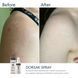Спрей-концентрат для тіла з бензоїл пероксидом Braderm Dorsak Spray A00244 фото 4
